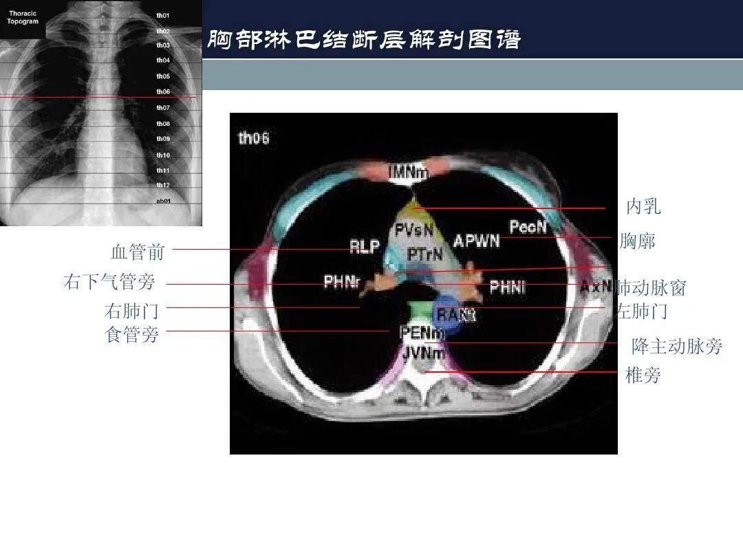 影像PPT - 【PPT】淋巴结引流的断层解剖与影像学分区-18