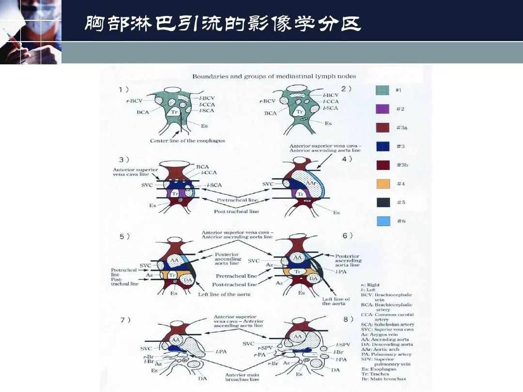 影像PPT - 【PPT】淋巴结引流的断层解剖与影像学分区-27