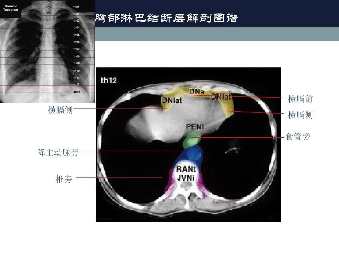影像PPT - 【PPT】淋巴结引流的断层解剖与影像学分区-24