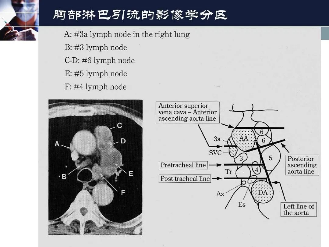 影像PPT - 【PPT】淋巴结引流的断层解剖与影像学分区-33