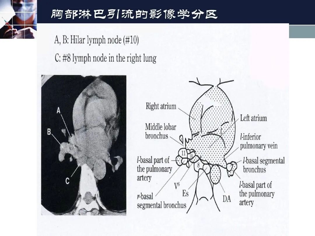 影像PPT - 【PPT】淋巴结引流的断层解剖与影像学分区-36