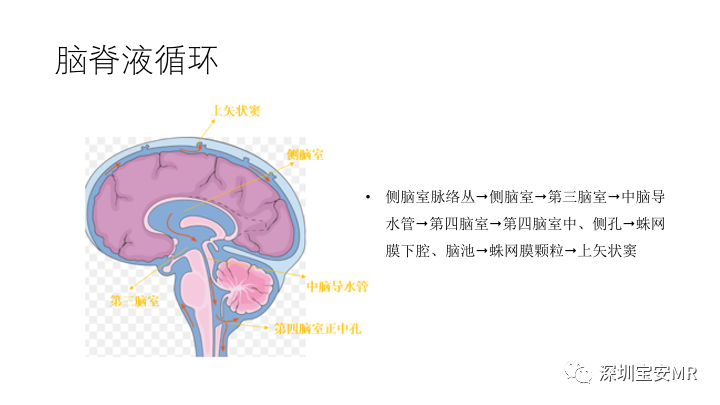 影像PPT - 【PPT】Dandy-Walker综合征-4
