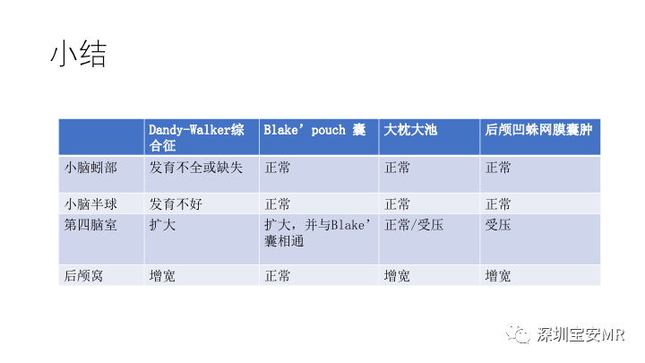 影像PPT - 【PPT】Dandy-Walker综合征-21