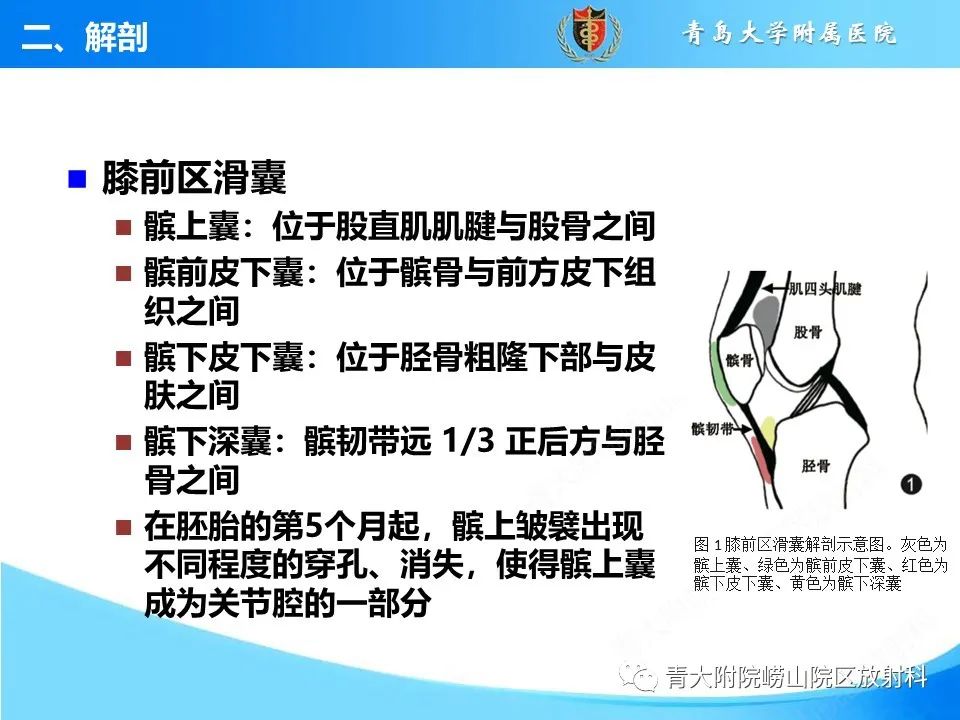 影像PPT - 【PPT】膝关节周围滑囊及其相关疾病的 MRI 表现-7