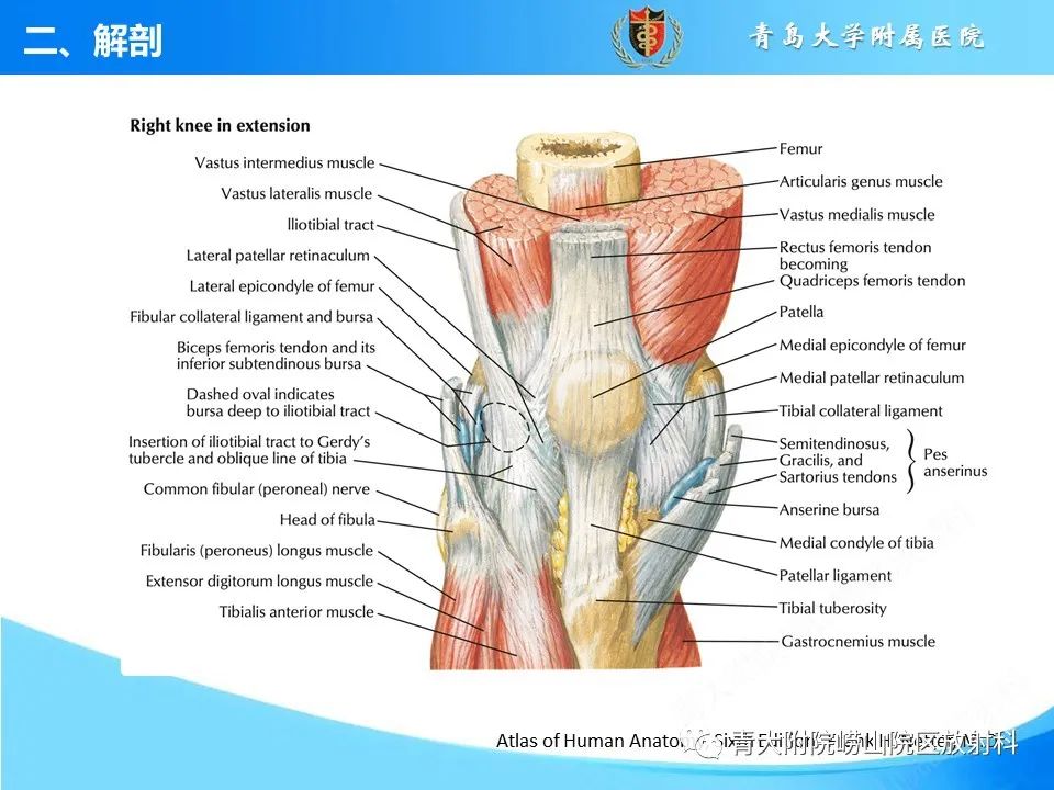 影像PPT - 【PPT】膝关节周围滑囊及其相关疾病的 MRI 表现-6