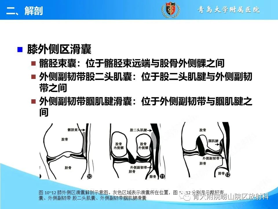 影像PPT - 【PPT】膝关节周围滑囊及其相关疾病的 MRI 表现-10
