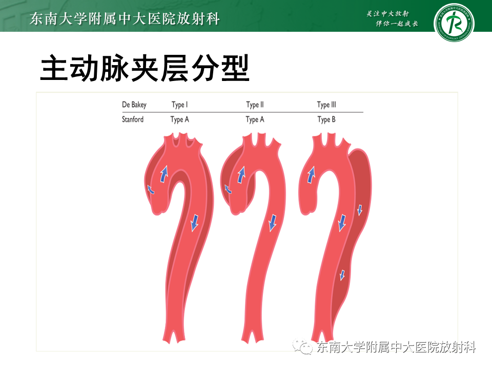 影像PPT - 【PPT】急性主动脉夹层-8
