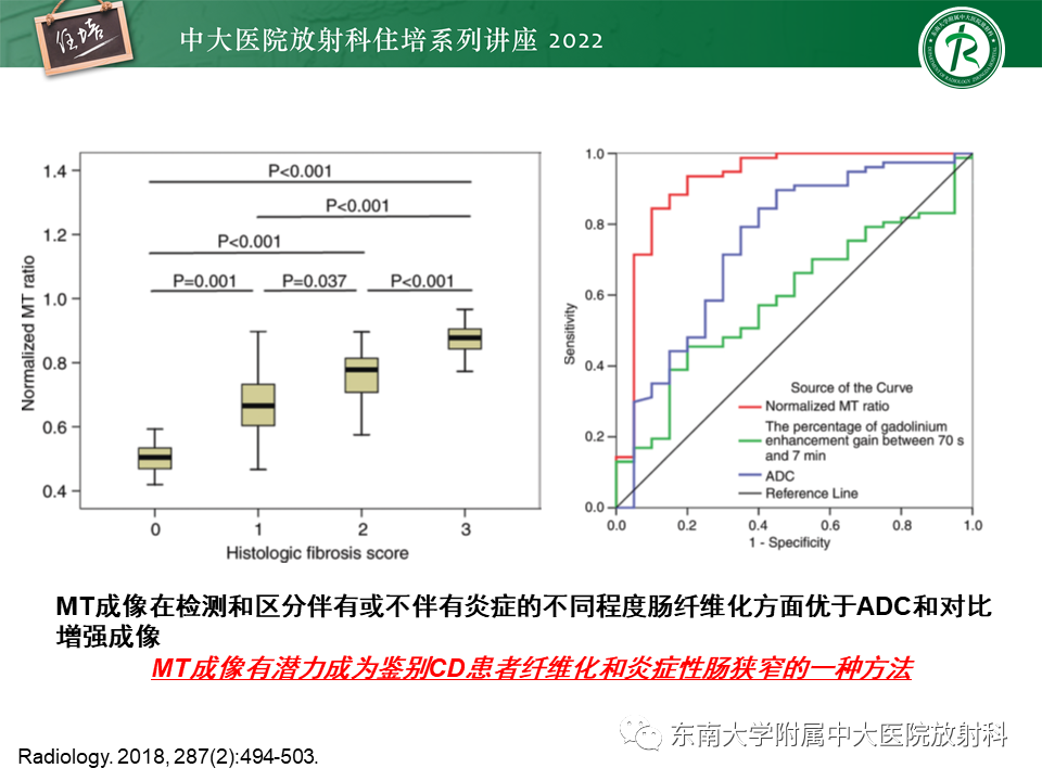 影像PPT - 【PPT】从临床关注点出发——克罗恩病影像再认识-30