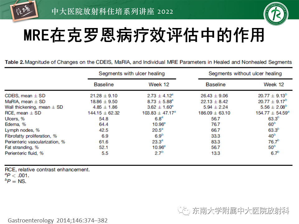 影像PPT - 【PPT】从临床关注点出发——克罗恩病影像再认识-44