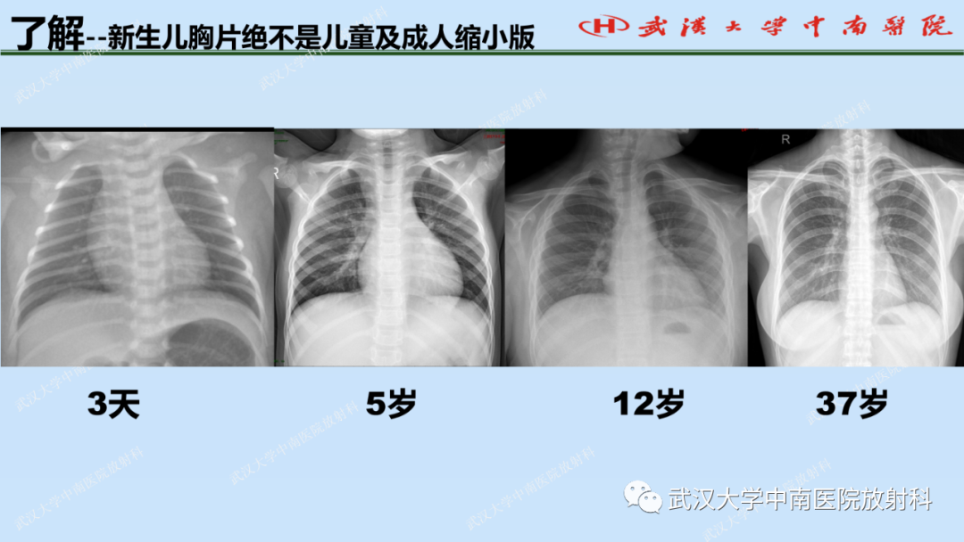影像PPT - 【PPT】新生儿胸腹部常见疾病影像诊断-7