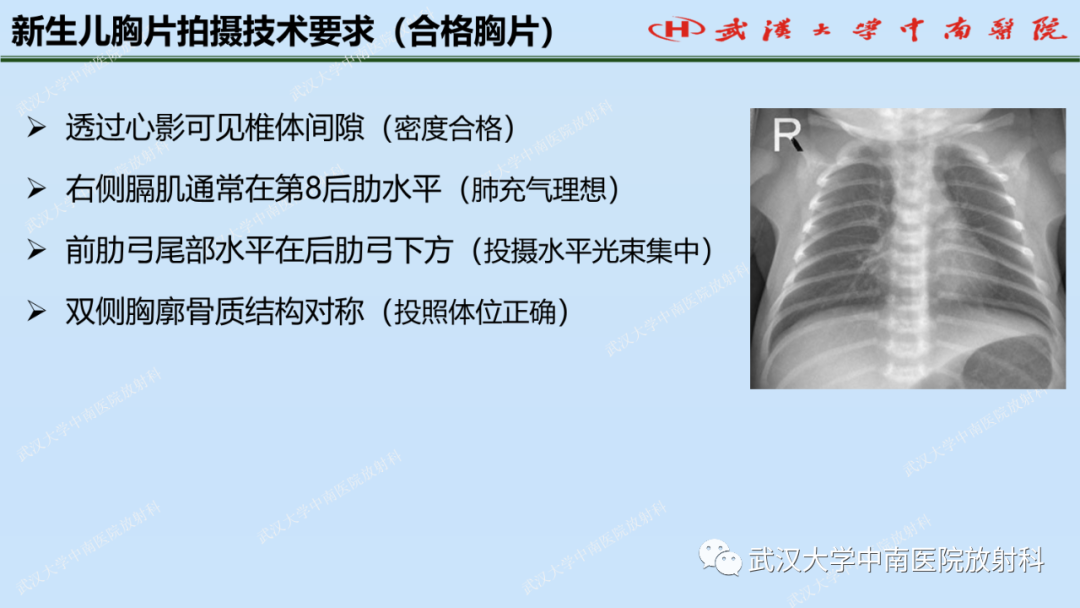 影像PPT - 【PPT】新生儿胸腹部常见疾病影像诊断-4