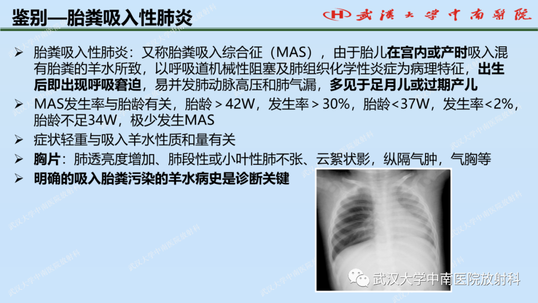 影像PPT - 【PPT】新生儿胸腹部常见疾病影像诊断-20