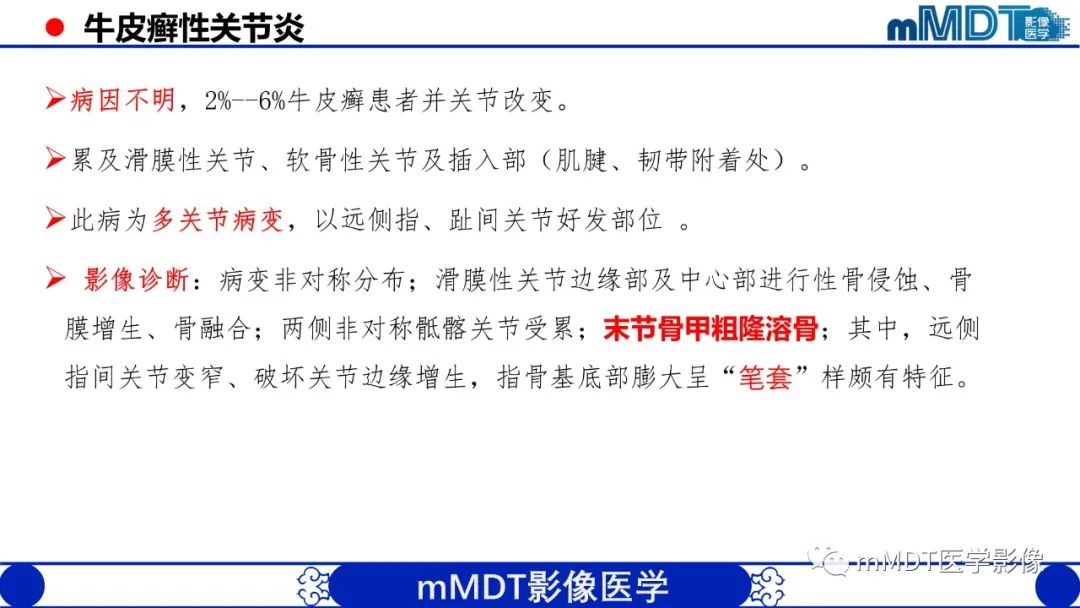 影像PPT - 【PPT】四肢短骨末端“消失”迷影追踪-22 影像PPT - 【PPT】四肢短骨末端“消失”迷影追踪-22