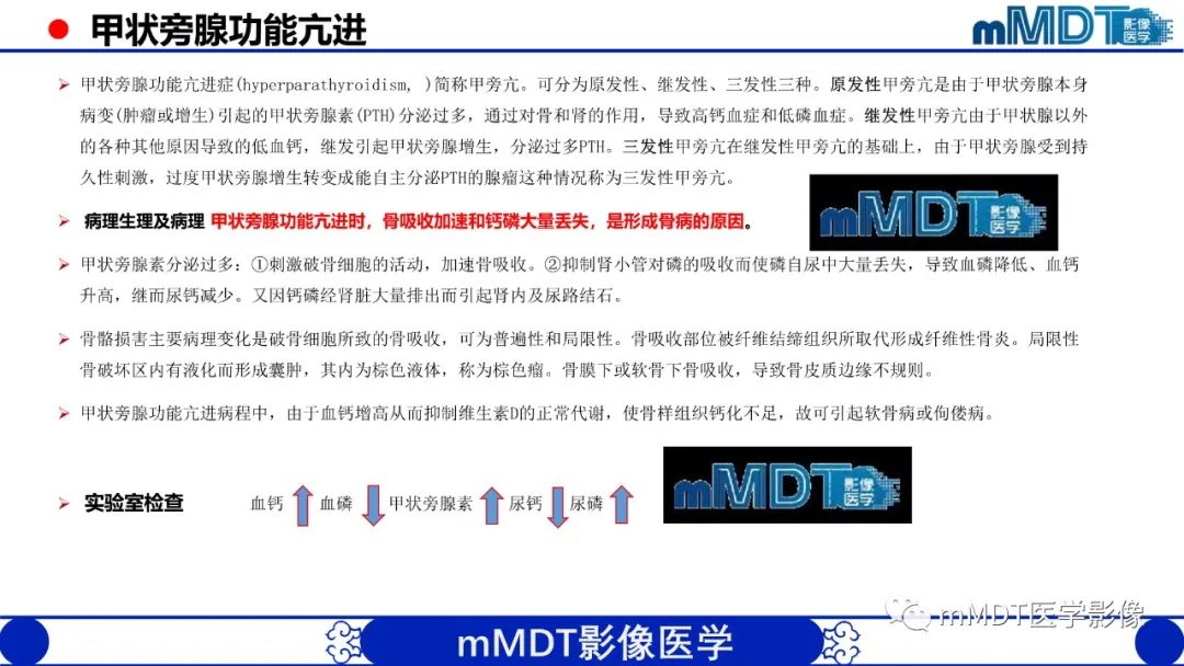 影像PPT - 【PPT】四肢短骨末端“消失”迷影追踪-26 影像PPT - 【PPT】四肢短骨末端“消失”迷影追踪-26