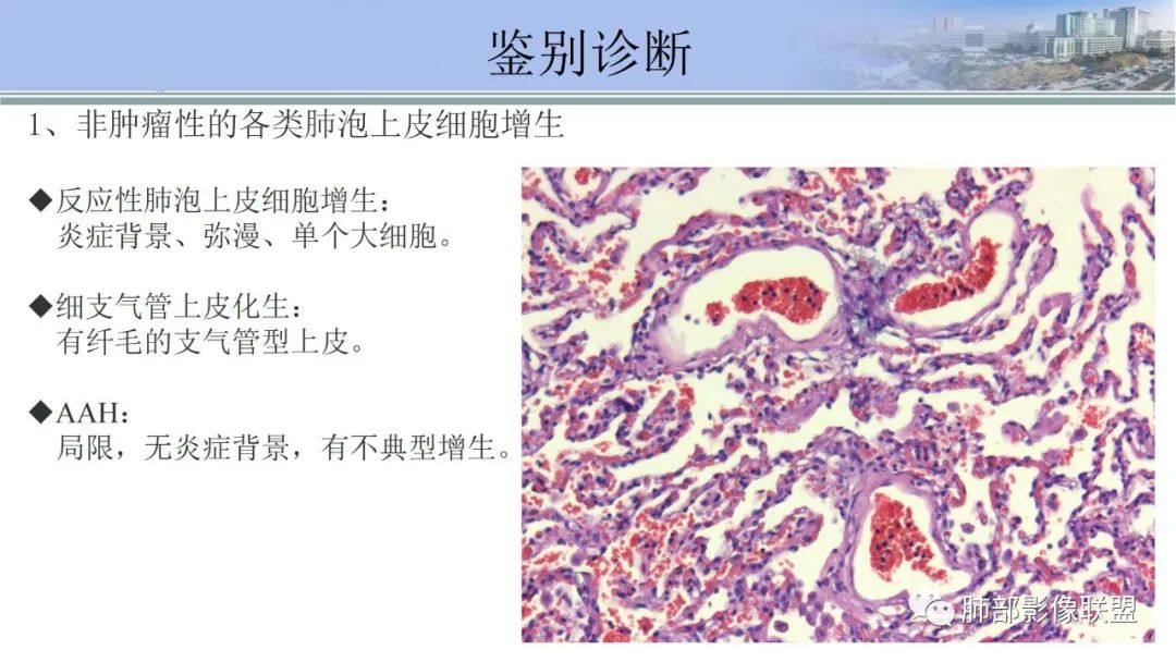 影像PPT - 【PPT】肺腺癌的病理诊断及鉴别诊断要点思考-8