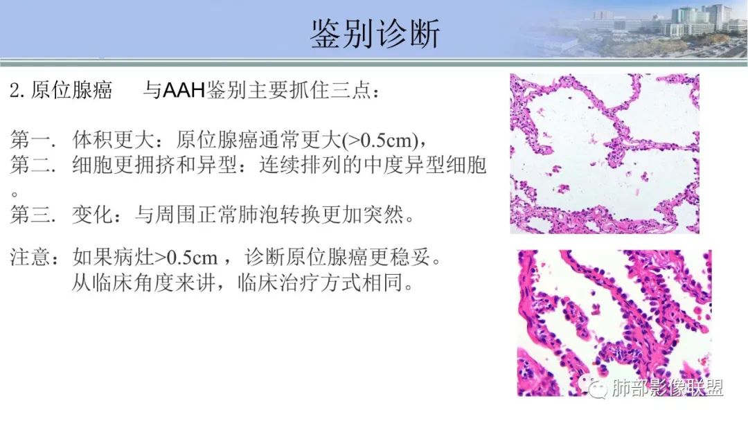 影像PPT - 【PPT】肺腺癌的病理诊断及鉴别诊断要点思考-12