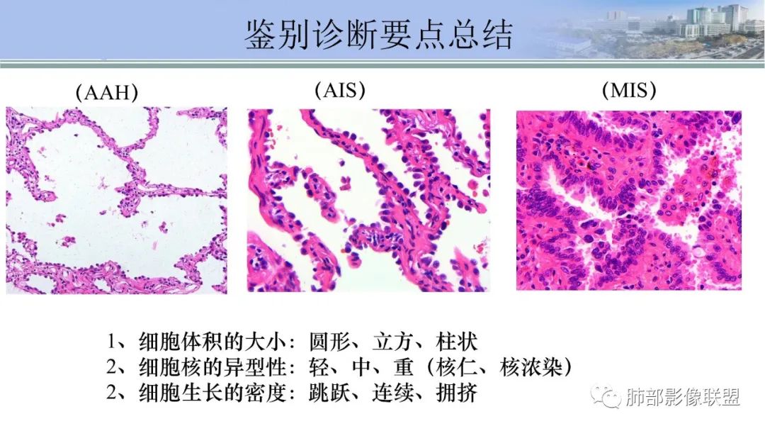 影像PPT - 【PPT】肺腺癌的病理诊断及鉴别诊断要点思考-20