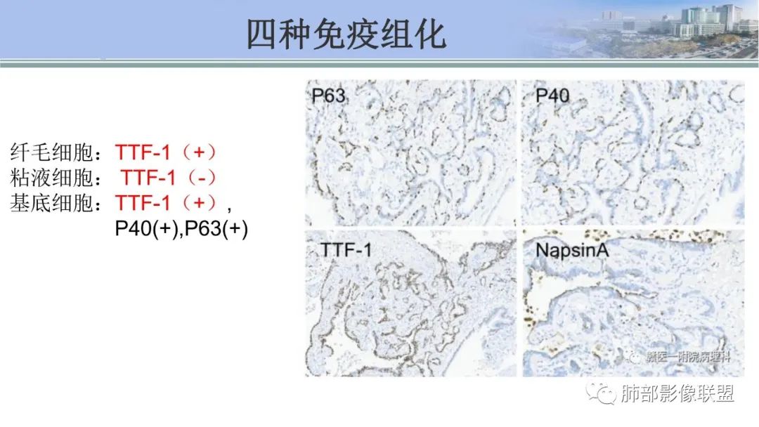 影像PPT - 【PPT】肺腺癌的病理诊断及鉴别诊断要点思考-65