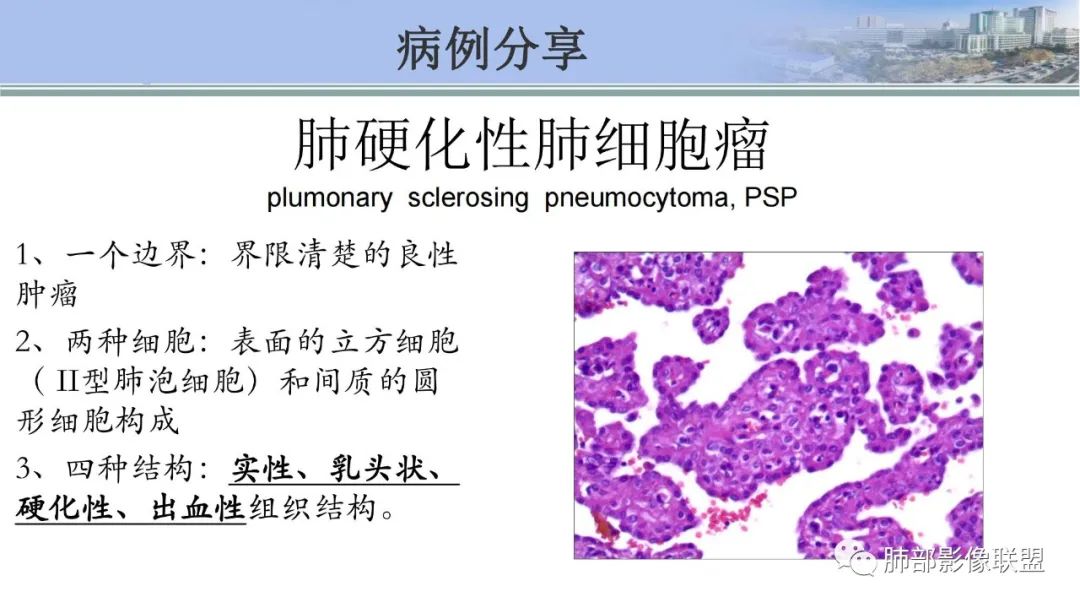 影像PPT - 【PPT】肺腺癌的病理诊断及鉴别诊断要点思考-73