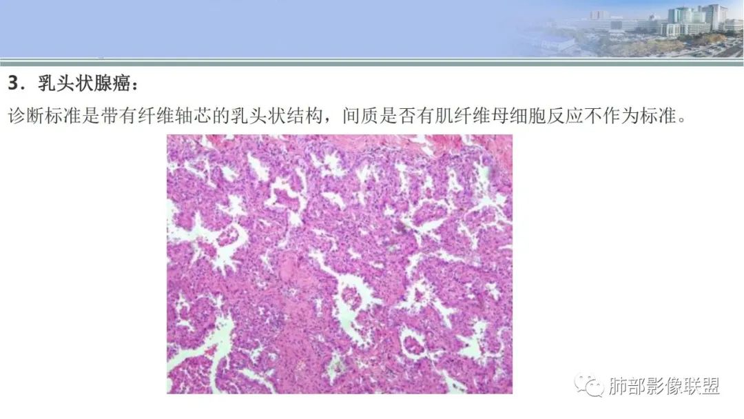 影像PPT - 【PPT】肺腺癌的病理诊断及鉴别诊断要点思考-45