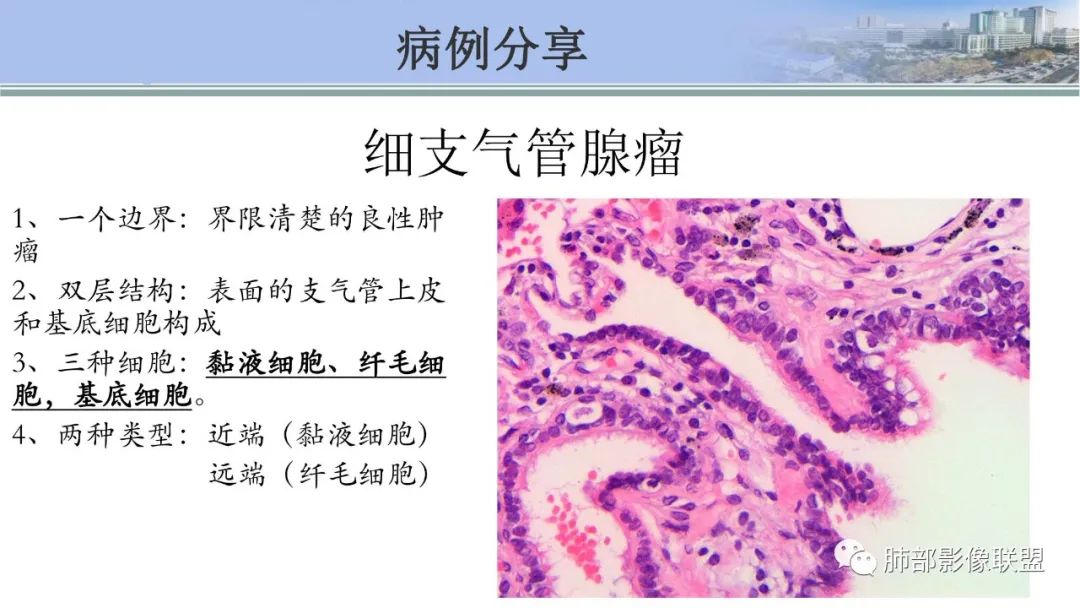 影像PPT - 【PPT】肺腺癌的病理诊断及鉴别诊断要点思考-61