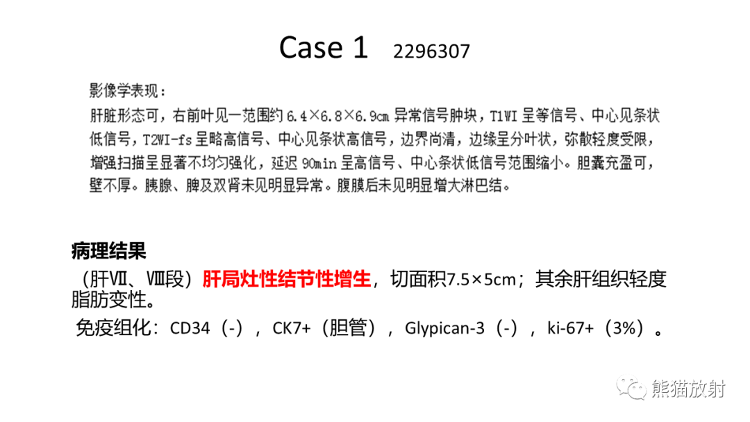 影像PPT - 【病例】局灶性结节性增生FNH VS 纤维板层型肝癌-27