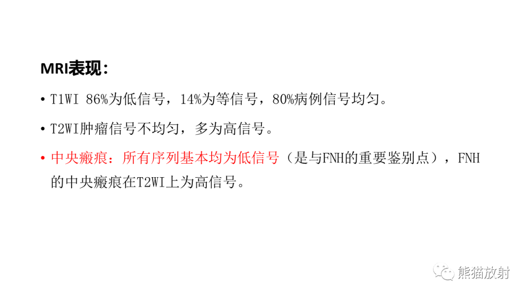 影像PPT - 【病例】局灶性结节性增生FNH VS 纤维板层型肝癌-46