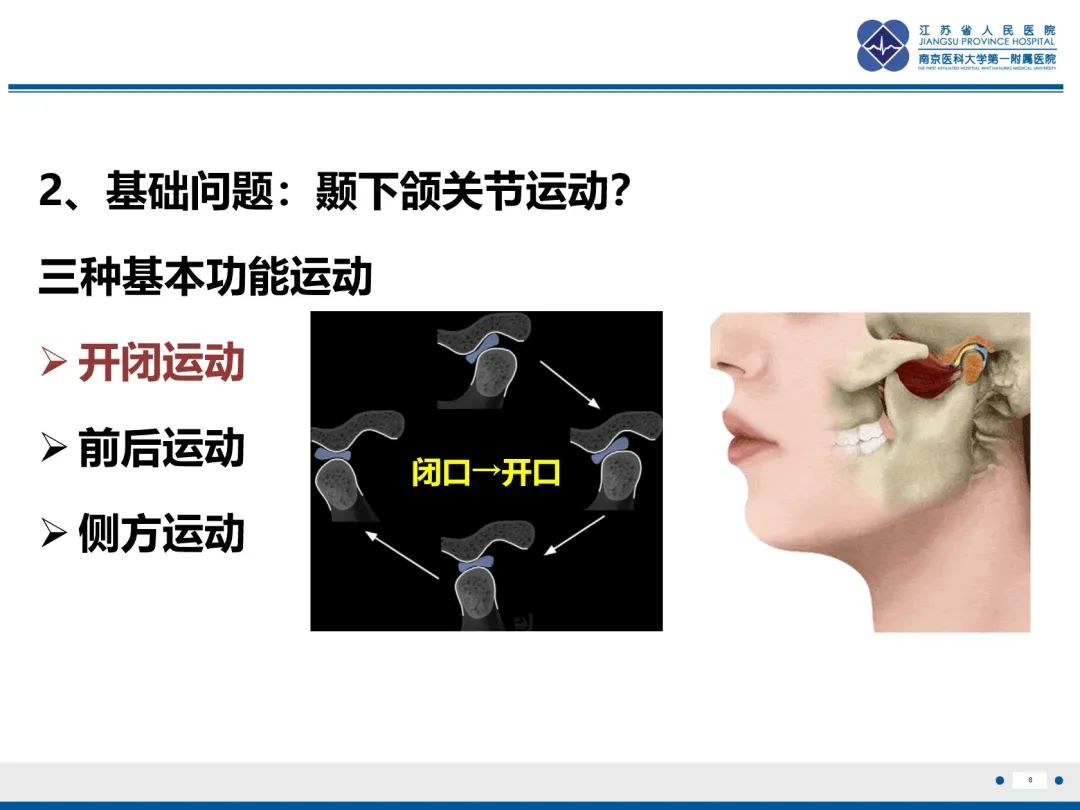 影像PPT - 【PPT】颞下颌关节紊乱病-9
