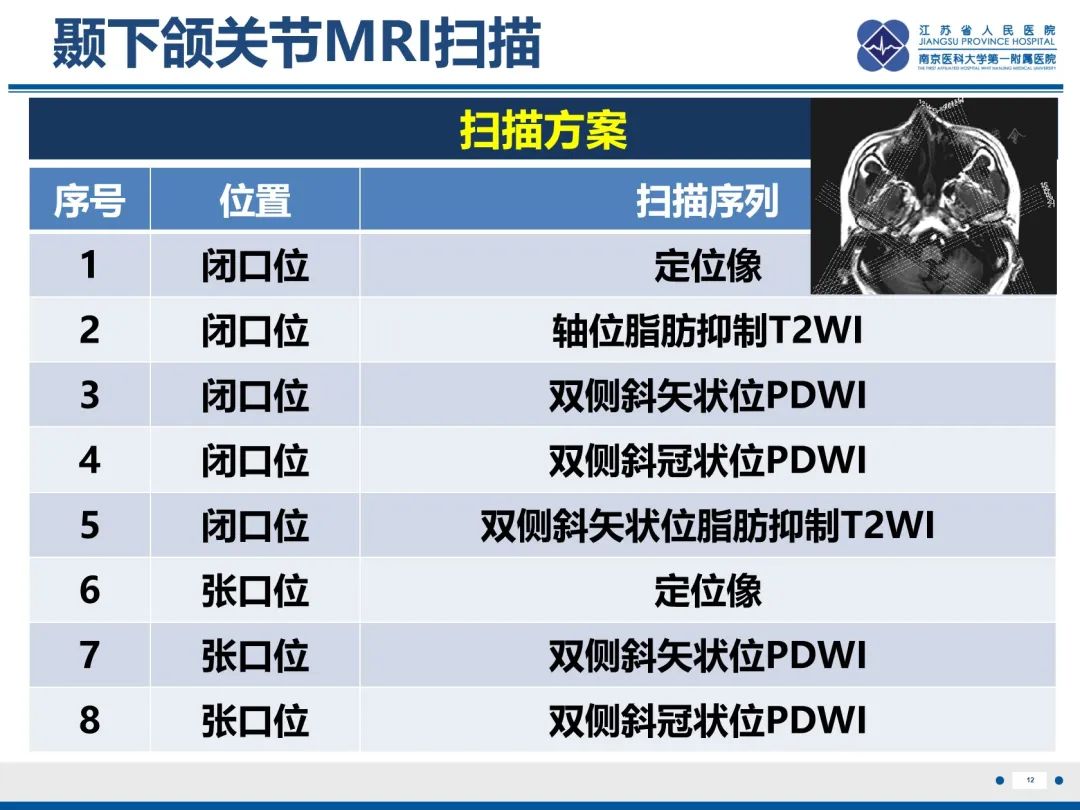 影像PPT - 【PPT】颞下颌关节紊乱病-13