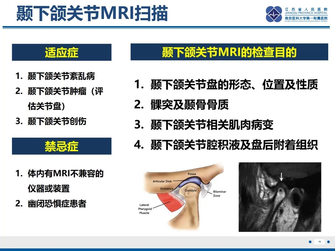 影像PPT - 【PPT】颞下颌关节紊乱病-11