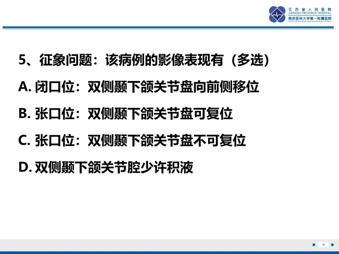 影像PPT - 【PPT】颞下颌关节紊乱病-17