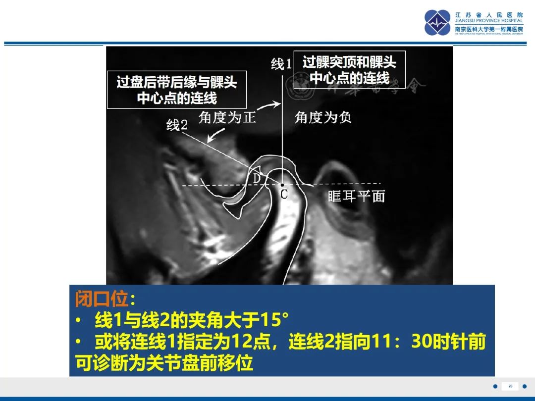 影像PPT - 【PPT】颞下颌关节紊乱病-27