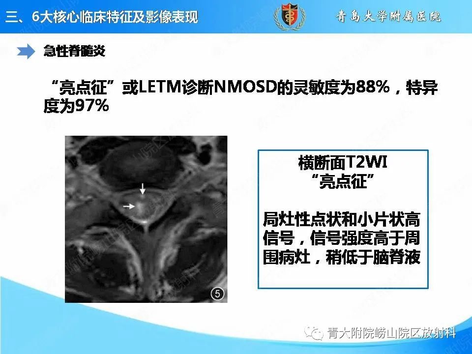 影像PPT - 【PPT】视神经脊髓炎谱系疾病的影像学诊断与鉴别诊断-11