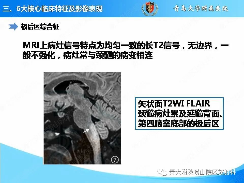 影像PPT - 【PPT】视神经脊髓炎谱系疾病的影像学诊断与鉴别诊断-14