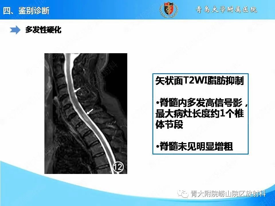 影像PPT - 【PPT】视神经脊髓炎谱系疾病的影像学诊断与鉴别诊断-22
