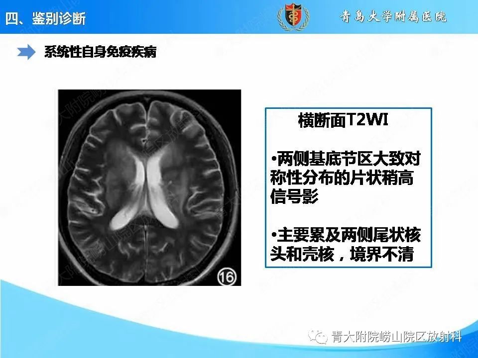 影像PPT - 【PPT】视神经脊髓炎谱系疾病的影像学诊断与鉴别诊断-27
