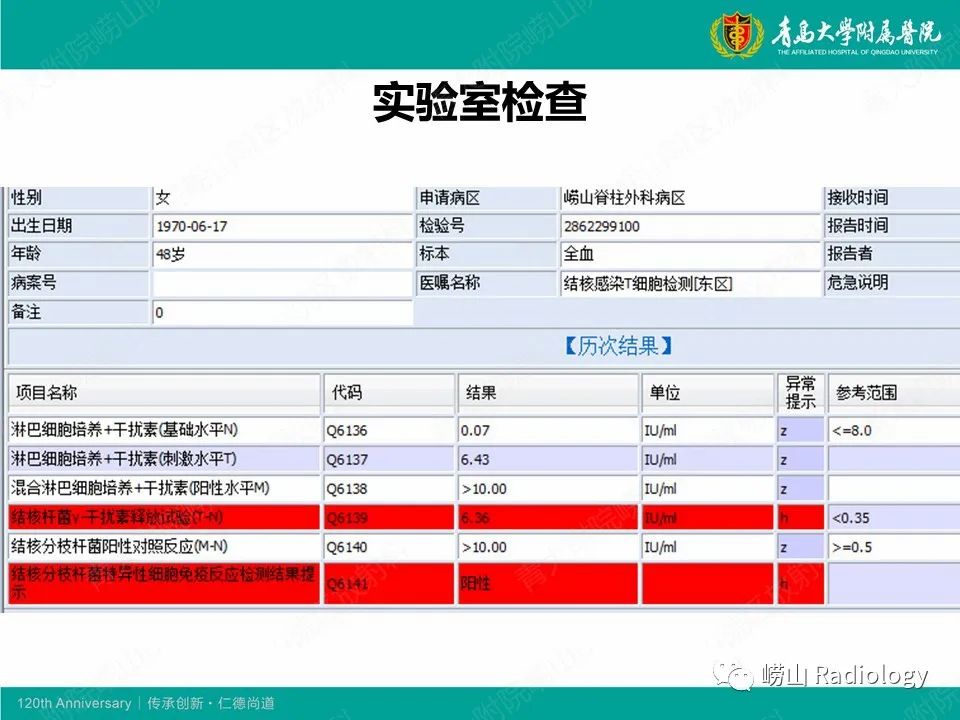 影像PPT - 【病例】脊椎结核1例CT及MR-11