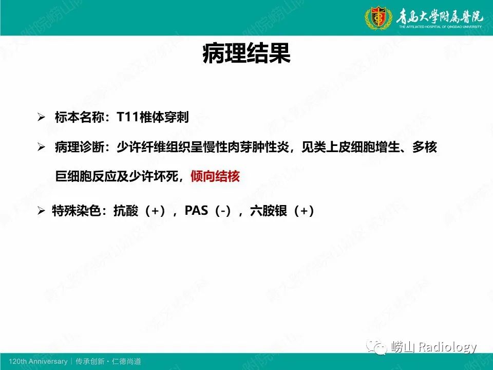 影像PPT - 【病例】脊椎结核1例CT及MR-9