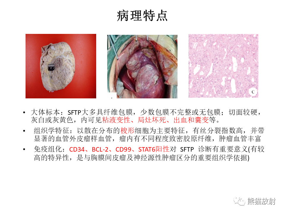 影像PPT - 【病例】胸膜孤立性纤维瘤2例CT影像-23