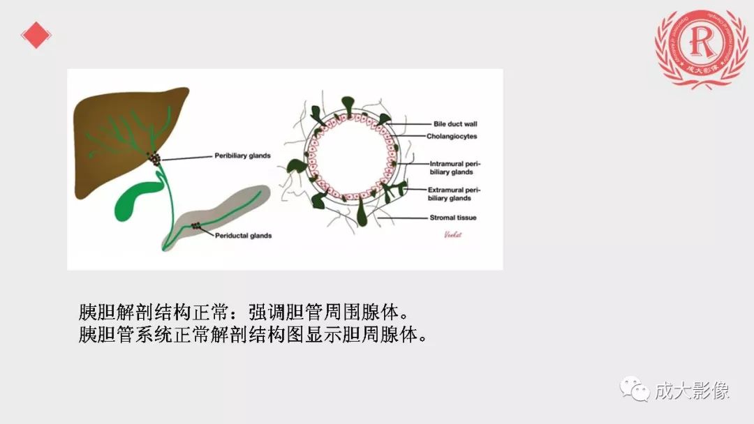 影像PPT - 【PPT】“对应性胆系胰腺疾病”的影像表现-5 影像PPT - 【PPT】“对应性胆系胰腺疾病”的影像表现-5