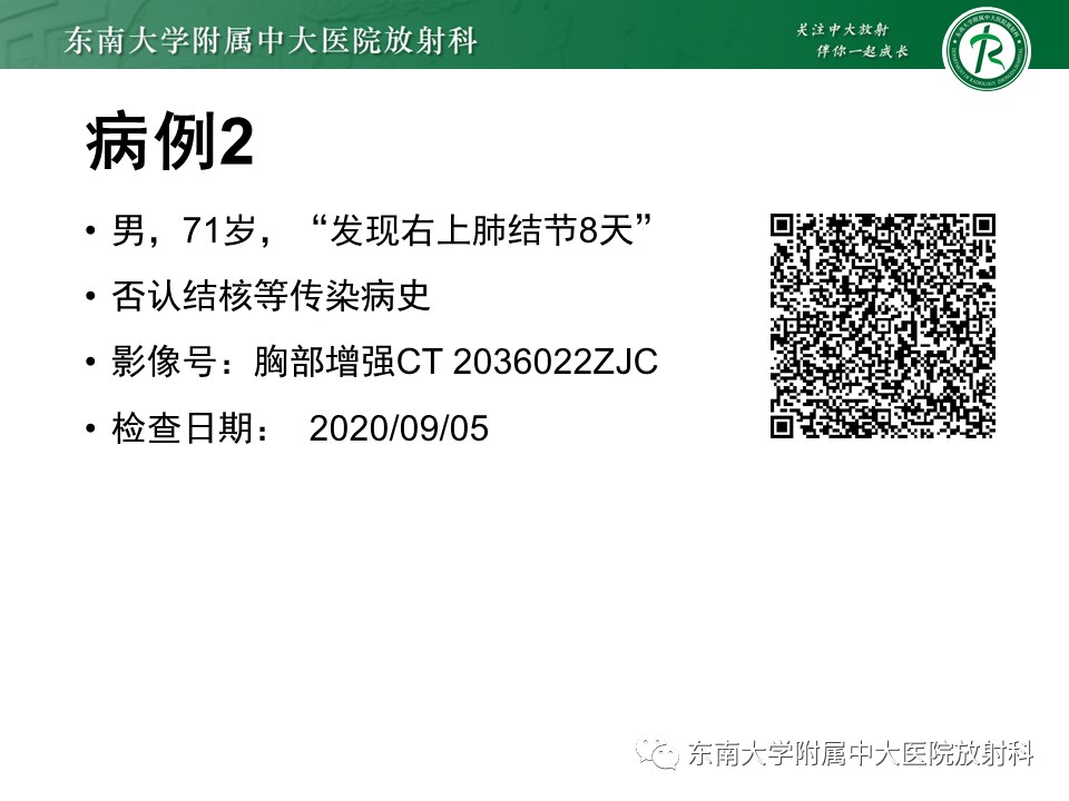 影像PPT - 【PPT】孤立性肺结节影像诊断-6