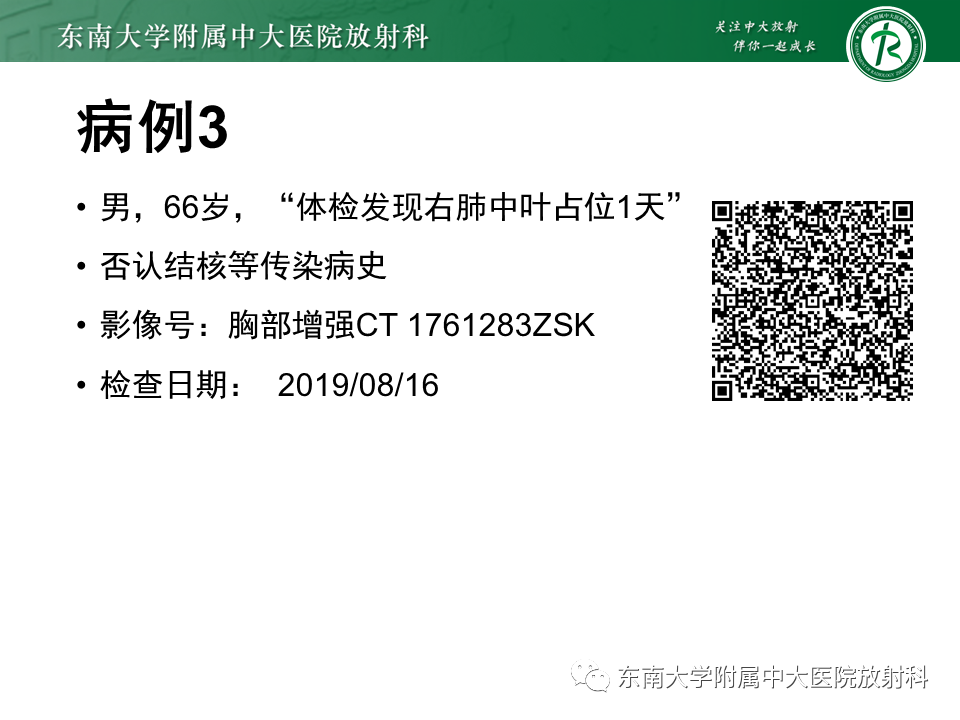 影像PPT - 【PPT】孤立性肺结节影像诊断-9