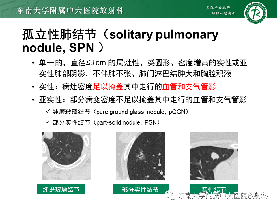 影像PPT - 【PPT】孤立性肺结节影像诊断-15