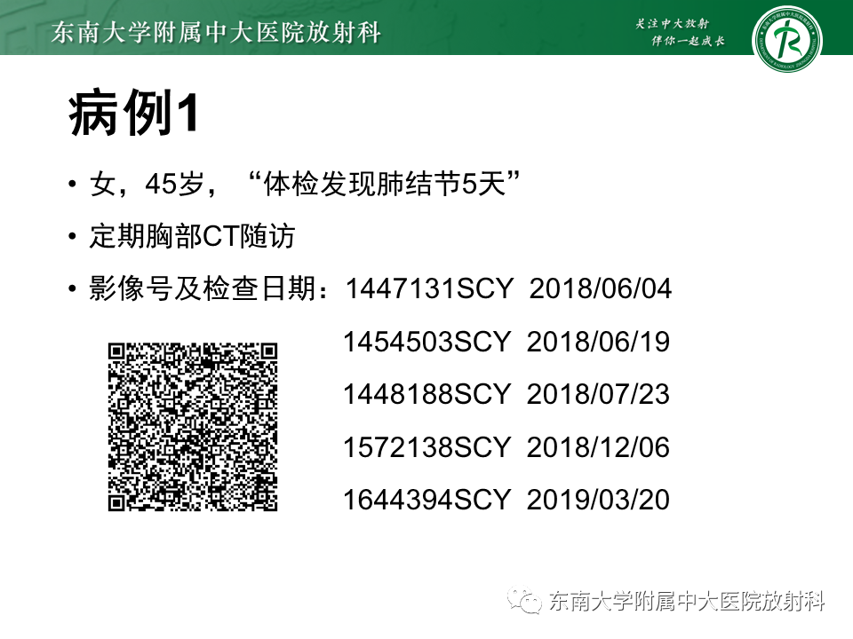 影像PPT - 【PPT】孤立性肺结节影像诊断-1