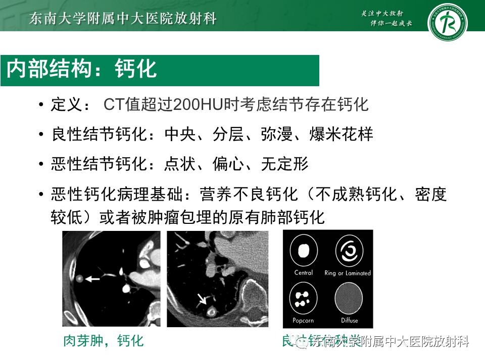 影像PPT - 【PPT】孤立性肺结节影像诊断-21