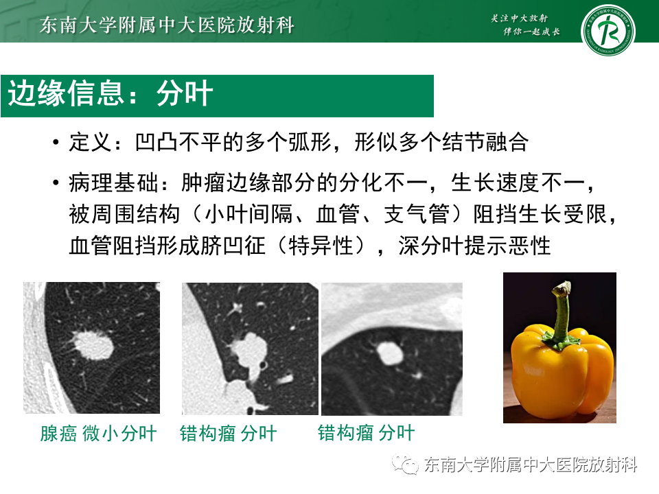 影像PPT - 【PPT】孤立性肺结节影像诊断-24