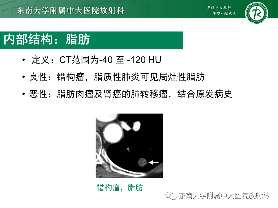 影像PPT - 【PPT】孤立性肺结节影像诊断-22
