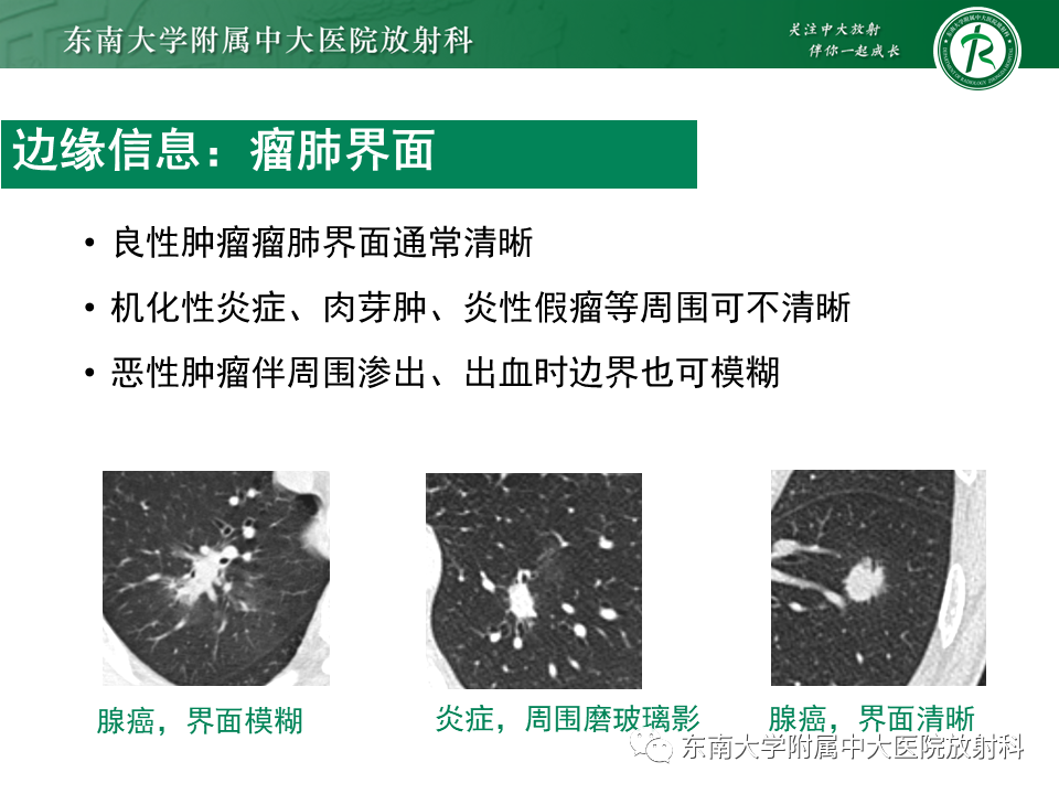 影像PPT - 【PPT】孤立性肺结节影像诊断-26