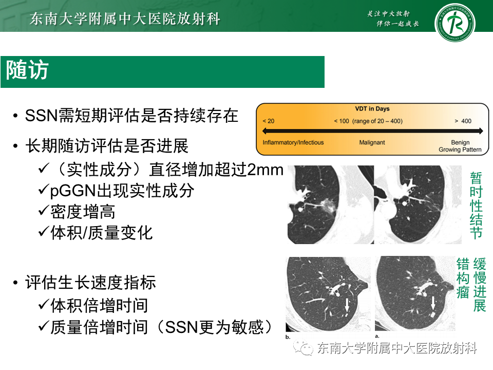 影像PPT - 【PPT】孤立性肺结节影像诊断-29