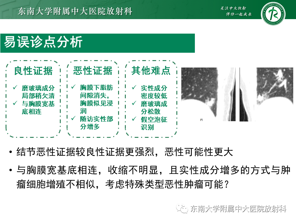 影像PPT - 【PPT】孤立性肺结节影像诊断-32